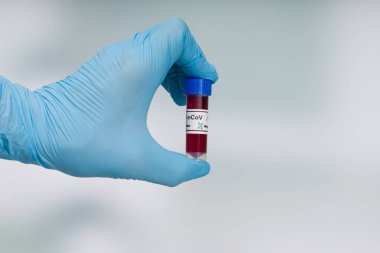Mavi eldivenlerle laboratuvar odasının önünde bir koronavirüs kan testi tüpü tutuyorlar.