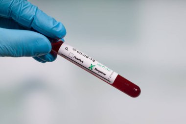 Mavi eldivenlerle laboratuvar odasının önünde bir koronavirüs kan testi tüpü tutuyorlar.
