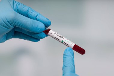 hand in blue gloves holding a coronavirus blood test tube in front of a lab room clipart