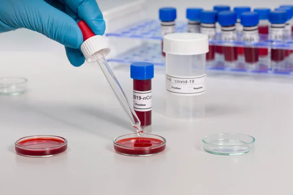 Penanganan Probe Untuk Menganalisis Untuk Memeriksa Untuk Coronavirus Laboratorium — Stok Foto