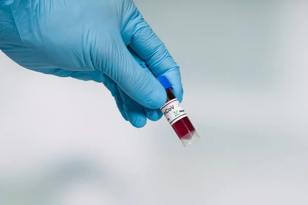 Рука Синіх Рукавичках Тримає Коронавірусну Пробірку Крові Перед Лабораторією — стокове фото