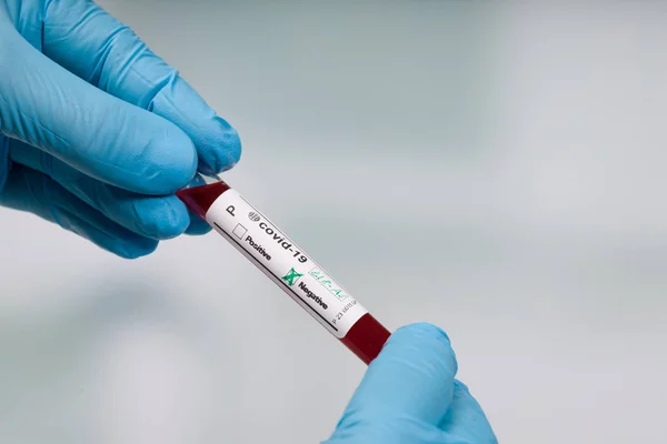 Рука Синіх Рукавичках Тримає Коронавірусну Пробірку Крові Перед Лабораторією — стокове фото