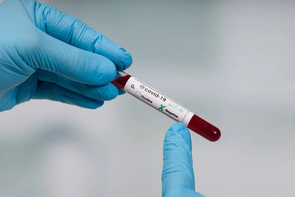 Hand Blue Gloves Holding Coronavirus Blood Test Tube Front Lab — Stock Photo, Image