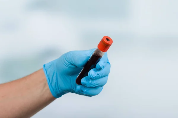 Hand Blå Handske Med Ett Blodprovsrör Framför Ett Labbrum — Stockfoto