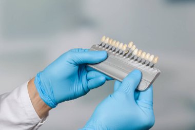 Diş kaplamasını kontrol etmek için diş beyazlatma laboratuarının gölge rehberini kapat. 