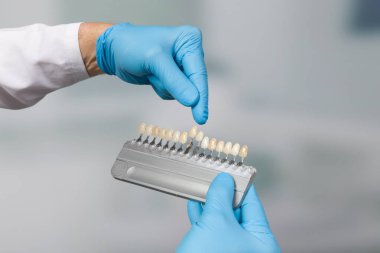 Diş hekimliğindeki diş kaplamalarını kontrol etmek için gölge rehberli bir dişçi.