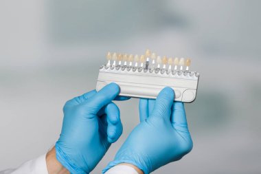 Diş hekimliğindeki diş kaplamalarını kontrol etmek için gölge rehberli bir dişçi.