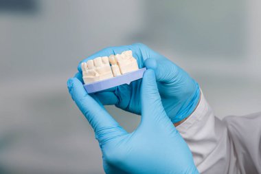 Eldivenli dişçi yapay dişlerin kullanılmaya hazır olduğunu söylüyor.