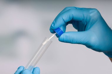 Bir tıp laboratuarında karalama testi yapmaya yakın. 