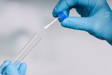 Bir tıp laboratuarında karalama testi yapmaya yakın. 