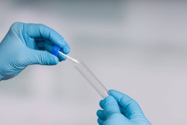 Virüs tespiti için tıbbi bir laboratuvarda karalama testi yapmaya yakın.