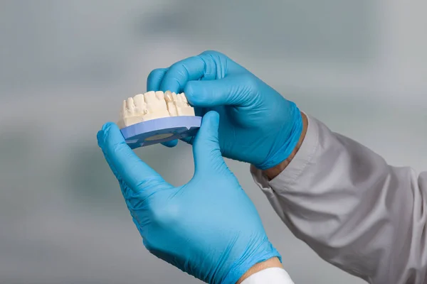 牙科医生手在医用手套中的近视 带有新的人造牙印 可随时使用 — 图库照片