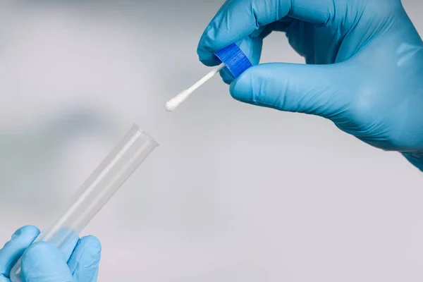 Close up of handling a smear test in a medical laboratory