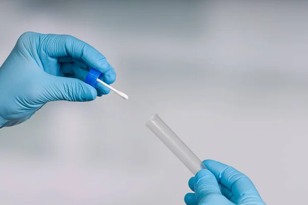 Close Handling Smear Test Medical Laboratory Virus Detection — Stock Photo, Image