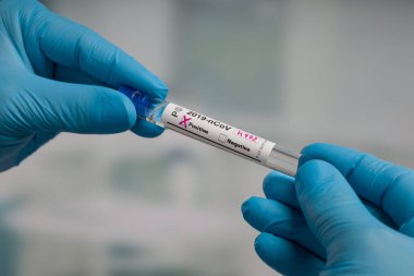 Virüs analizinden sonra laboratuvar odasının önünde test tüpü tutan mavi eldivenleri teslim et.