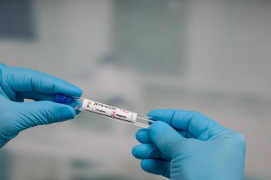 Virüs analizinden sonra laboratuvar odasının önünde test tüpü tutan mavi eldivenleri teslim et.