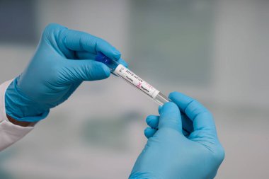 Virüs analizinden sonra laboratuvar odasının önünde test tüpü tutan mavi eldivenleri teslim et.