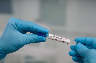 Virüs analizinden sonra laboratuvar odasının önünde test tüpü tutan mavi eldivenleri teslim et.