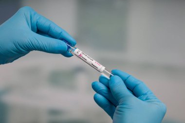 Virüs analizinden sonra laboratuvar odasının önünde test tüpü tutan mavi eldivenleri teslim et.