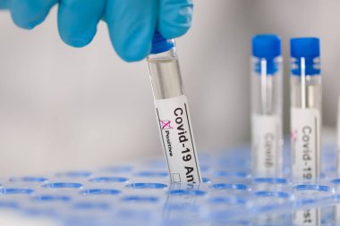 Coronavirus test tüplerini tutan tıbbi eldivenleri giyin.