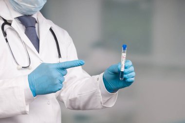 Doktorun elinde virüs analizinden sonra laboratuvar odasının önünde test tüpü var.  
