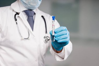Doktorun elinde virüs analizinden sonra laboratuvar odasının önünde test tüpü var.  