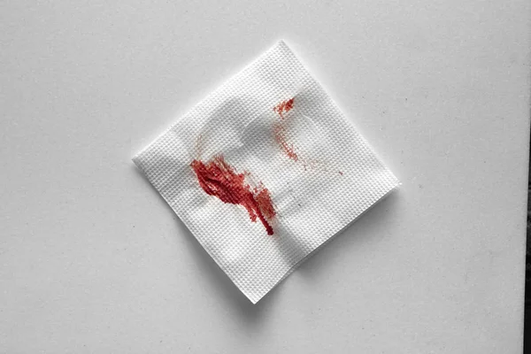 Papírový ubrousek v krvi. Zastavení krve improvizovanými prostředky. — Stock fotografie