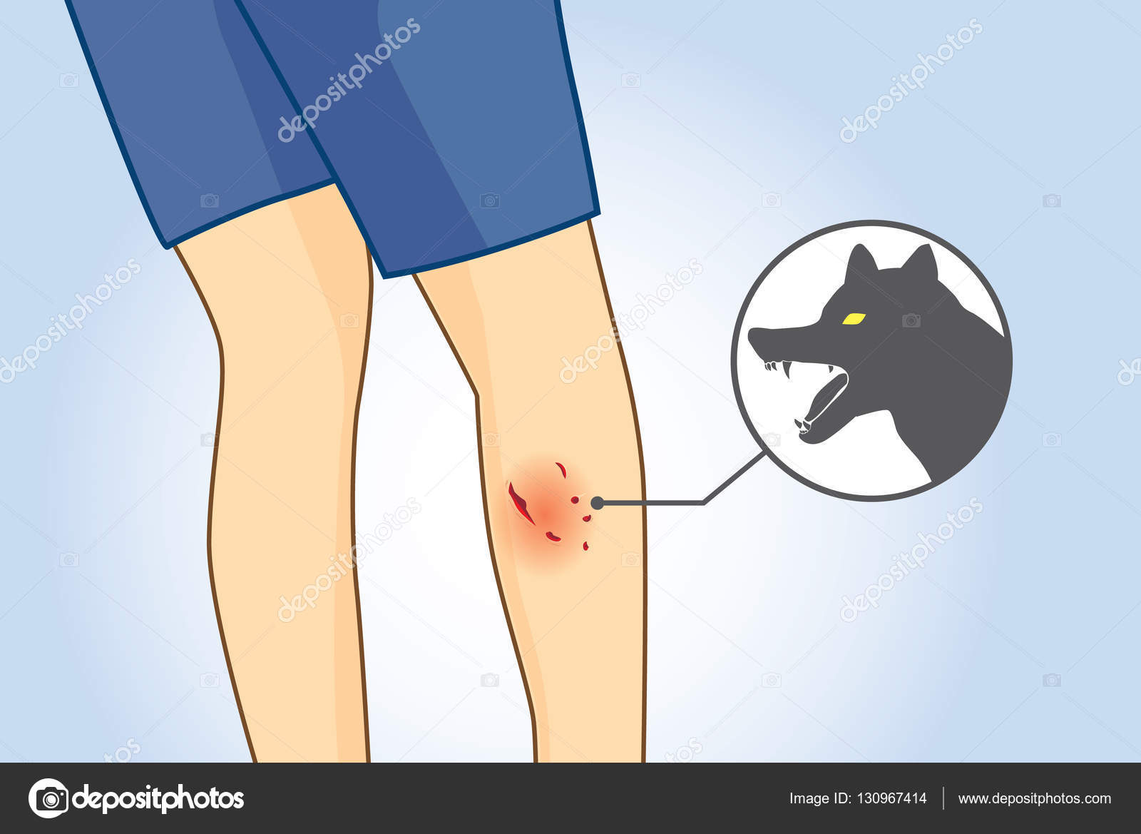 What Can You Put On A Dog Bite Wound