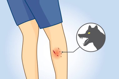 Köpek ısırık yarası baldır bacak.