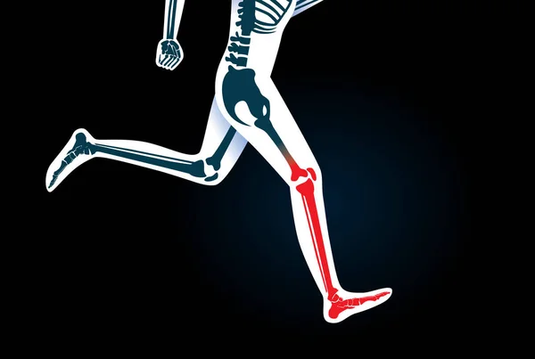 Человеческая нога и нога во время бега имеют красный сигнал . — стоковый вектор