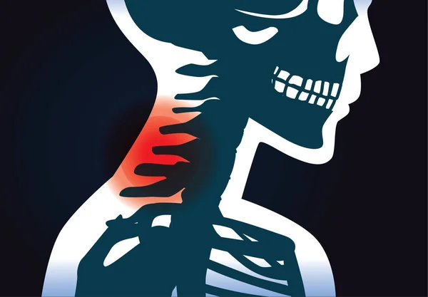 Os du cou ont des symptômes de douleur . — Image vectorielle