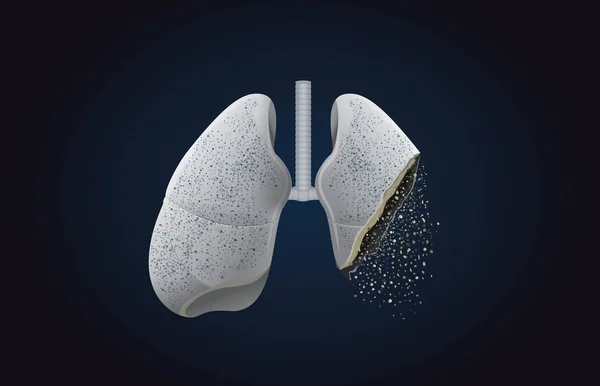 Die graue Lunge verwandelt sich in Asche. — Stockvektor