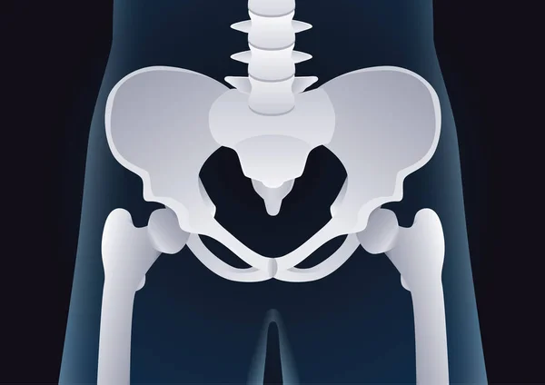 X-ışını kavram insan pelvik kemik normal şeklini. — Stok Vektör