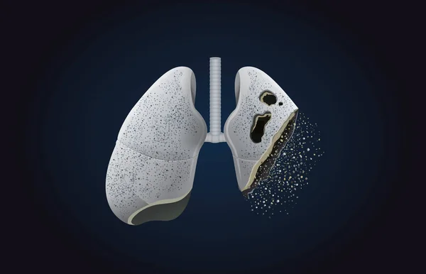 The gray lung transform into ashes. — Stock Vector