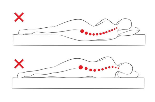 La alineación incorrecta de la columna vertebral al dormir . — Vector de stock