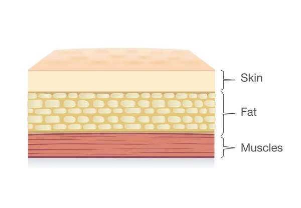 Anatomia da camada da pele, célula gorda e camada muscular em estilo vetorial . —  Vetores de Stock