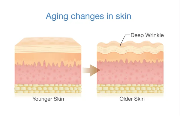 Aging Changes in Skin — Stock Vector