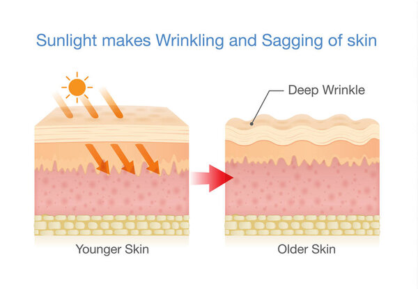 От солнечного света кожа обвисает
.