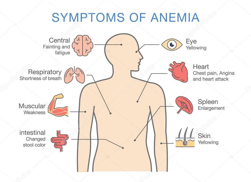 Symptoms common to many types of Anemia.