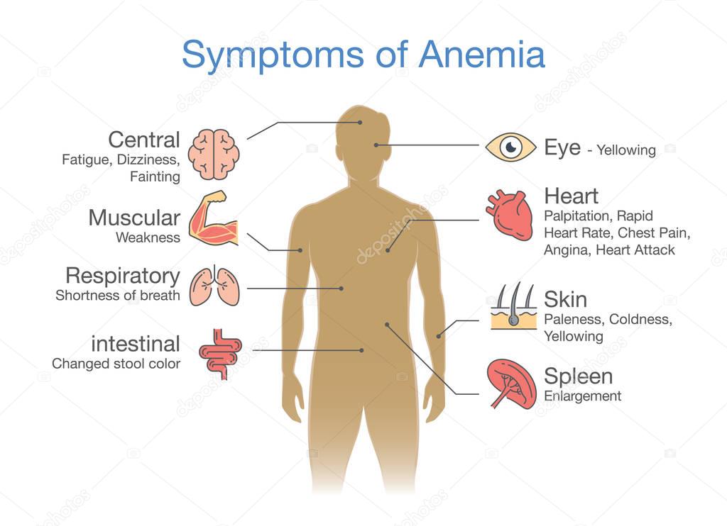 The most common Symptom of Anemia. 