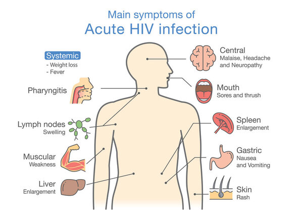 Diagram of Main symptoms of AIDS.