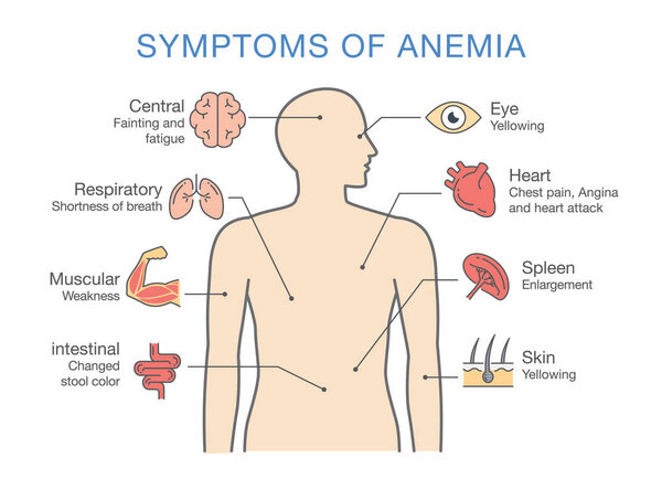 Symptoms common to many types of Anemia. 