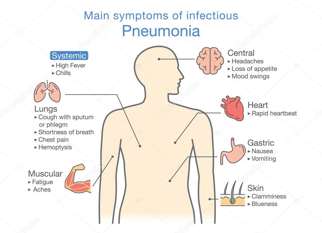 Diagram of main symptoms of infectious Pneumonia.