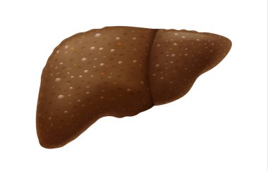 İnsan karaciğer ağır içki üzerinden skar dokusu sorun var.