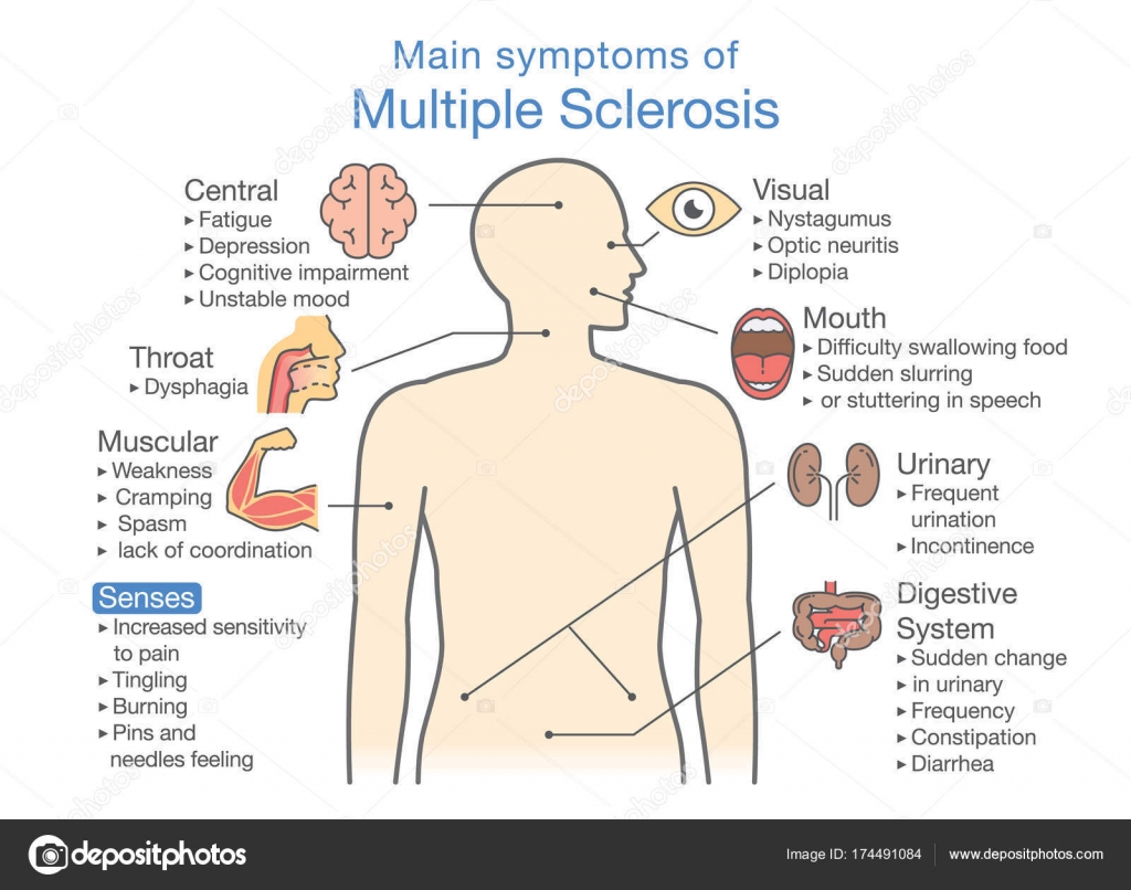 Multiple Sclerosis Symptoms Chart