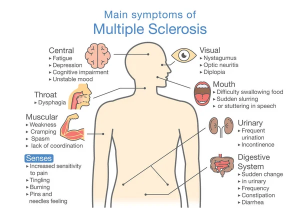 Hauptsymptome der Multiplen Sklerose. — Stockvektor