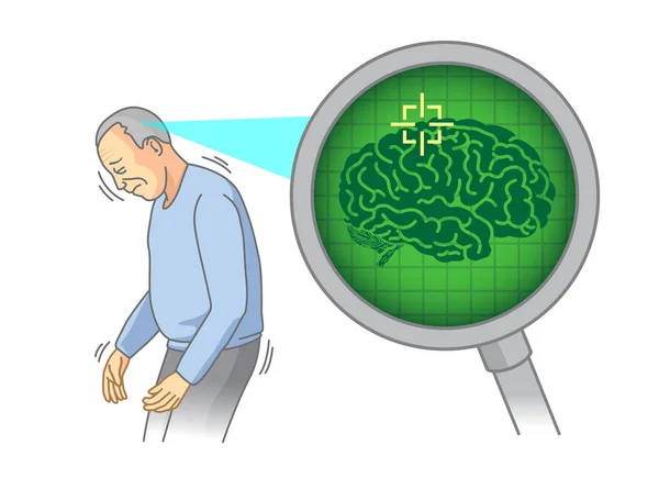 Controleer Binnenkant Van Bejaarde Hersenen Met Vergrootglas Illustratie Medische Scan — Stockvector