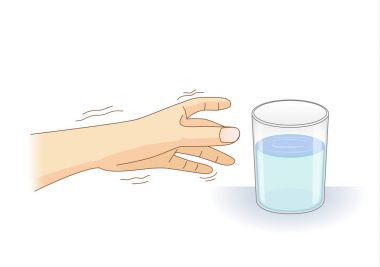 Bir bardak su için uzanarak sarsıntı belirti bir el var. Kaybı ile ilgili resmi denetim denge ve beden ve sağlık sorununun.