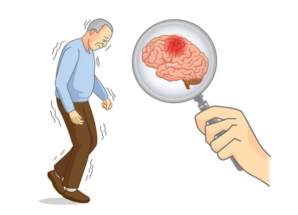 Controleer Binnenkant Van Bejaarde Hersenen Met Vergrootglas Illustratie Medische Scan — Stockvector