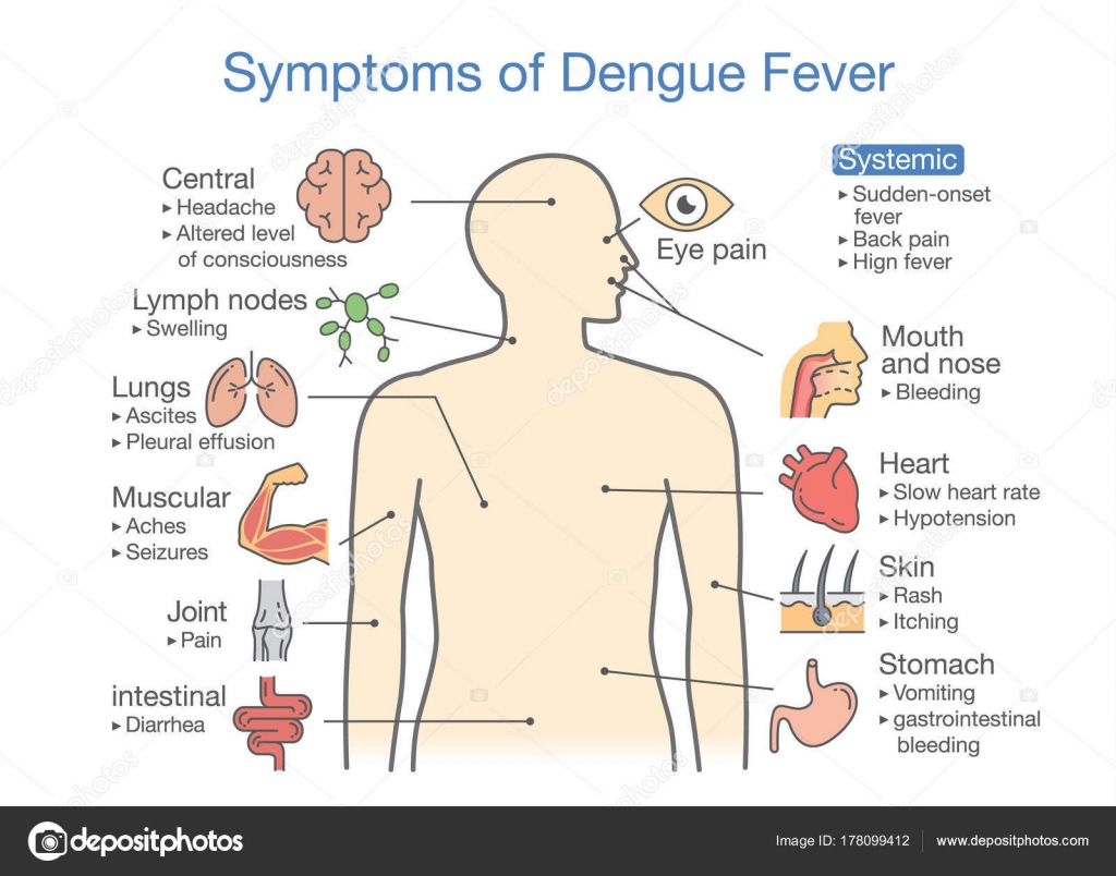 dengue